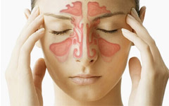 Bestel Sinusitis - allergische rhinitis veilig online bij Medstore